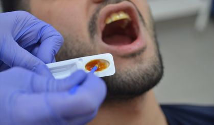 Diş hassasiyeti olanlar için "florsuz vernik" geliştirildi